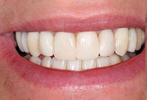 Pacific Family Dentistry | Pediatric Dentistry, Teeth Whitening and Veneers